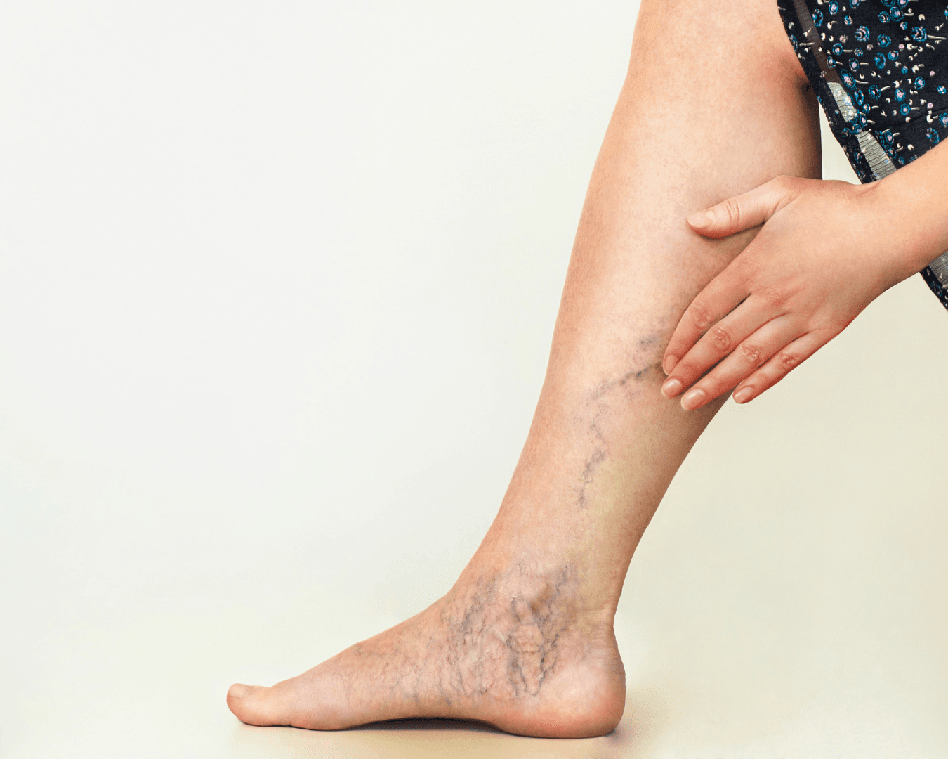 Varis çeşitleri aynı mıdır?